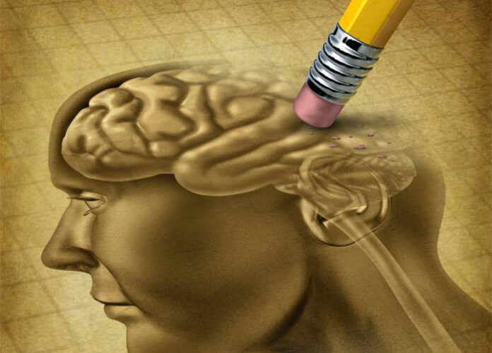 alzheimer