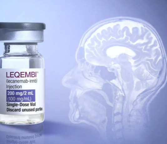 Sanidad rechaza financiar el Leqembi, el fármaco que frena el alzhéimer, por su elevado coste público