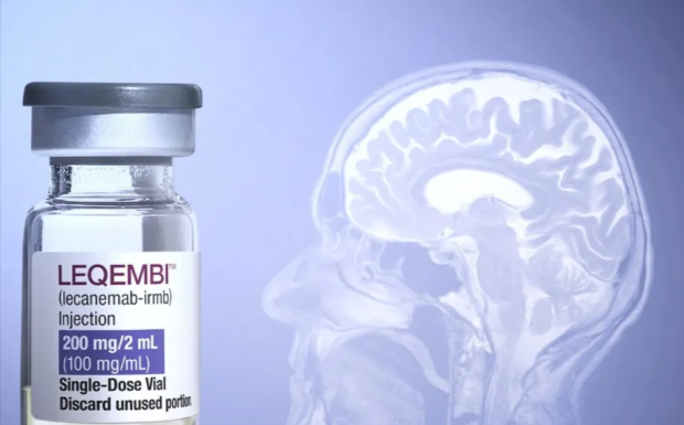 Sanidad rechaza financiar el Leqembi, el fármaco que frena el alzhéimer, por su elevado coste público